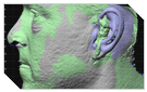 Custom Prostheses - Digitally Copying Ear