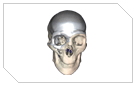 Direct 3Dview - Skull Implant
