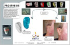 Projects - Ear Prosthesis